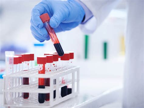 laboratory blood analysis|blood analysis tests.